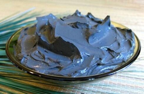 Therapeutic mud is very useful for prostatitis, but it is not indicated for all patients.